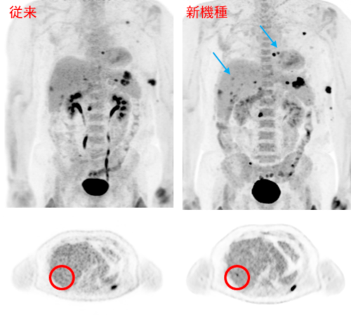 ̊PET摜